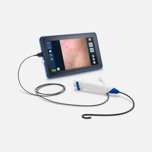VersaVue™ Single-Use Flexible Cystoscope and Tablet