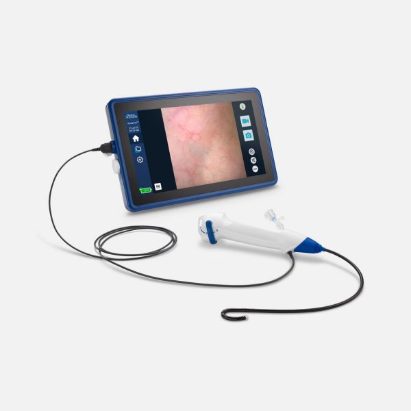 VersaVue™ Single-Use Flexible Cystoscope and Tablet